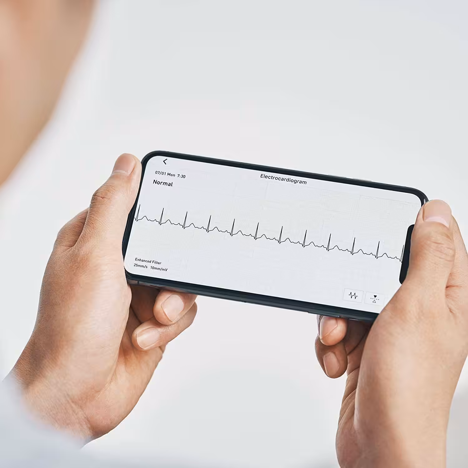 Omron Complete HEM 7530T 2si 1 Arada Tansiyon Aleti ve EKG Cihazı