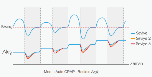 cpap ayarı